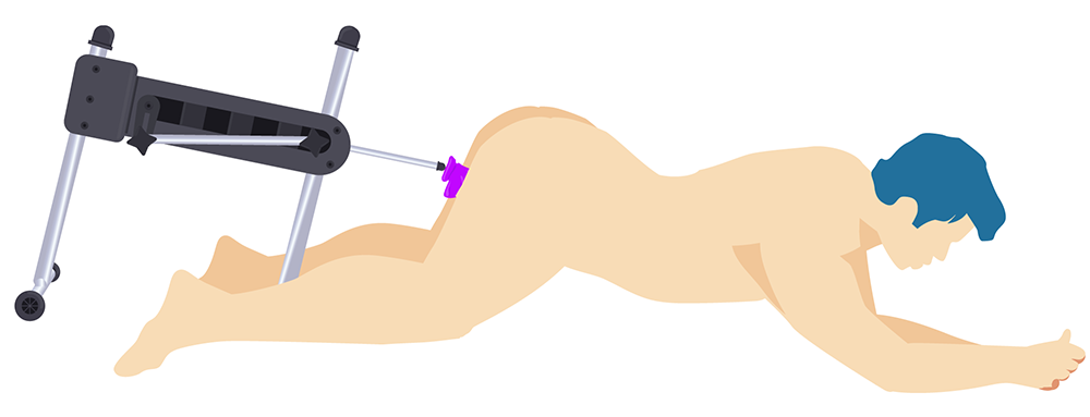 Prone Position With A Sex Machine (Illustration)