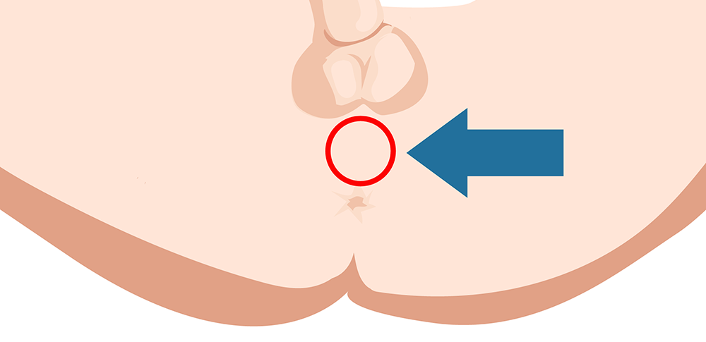 The location of the Perineum