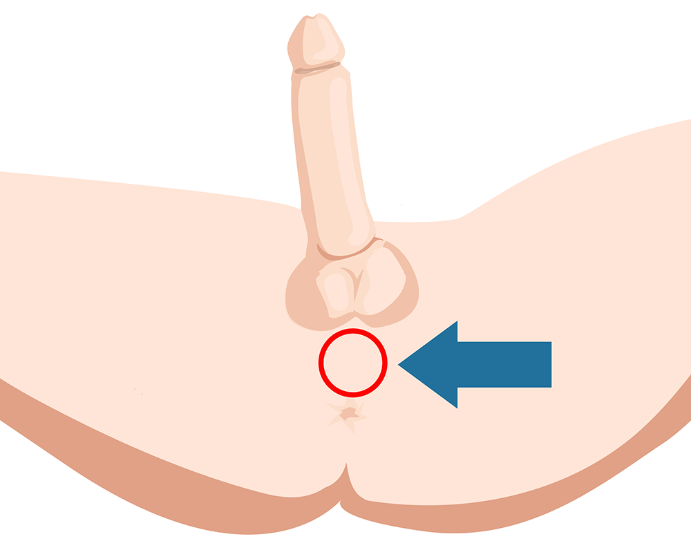 The location of the Perineum
